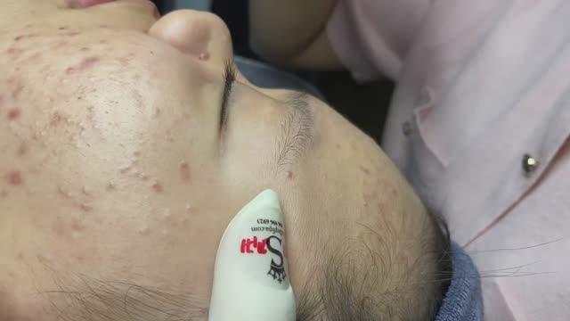 ЛЕЧЕНИЕ АКНЕ удовлетворение и релакс