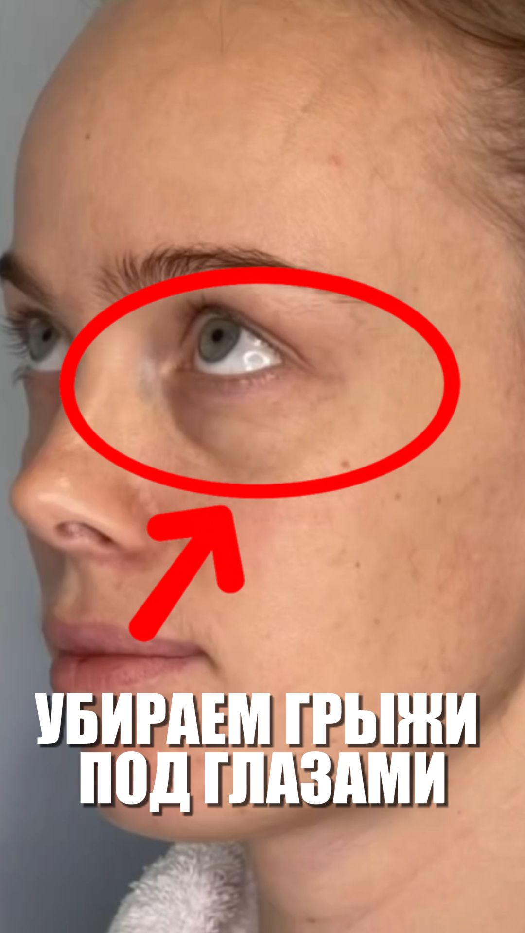 УБИРАЕМ ГРЫЖИ ПОД ГЛАЗАМИ И НАВИСАЮЩЕЕ ВЕКО