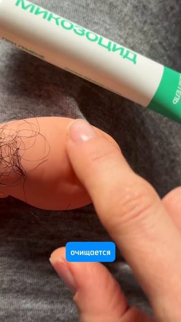 Быстрый способ от грибка