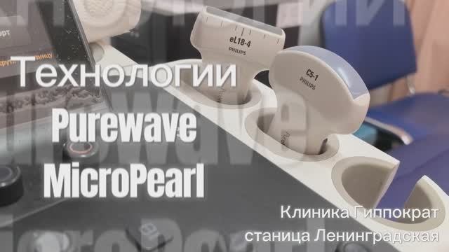 УЗИ на Philips Epiq 5 в клинике «Гиппократ» в станице Ленинградской: четкость, которой вы не видели