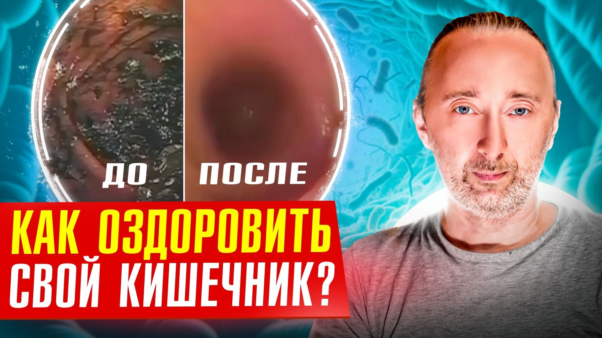 Живые бактерии из йогуртов попадая в ЖКТ не закрепляются там!