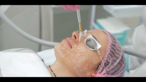 XEO Cutera LimeLight | Фотоомоложение | Центр косметологии Место под солнцем