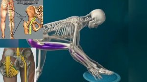 Сдавленный седалищный нерв мешает жить ногам, спине, мозгу.