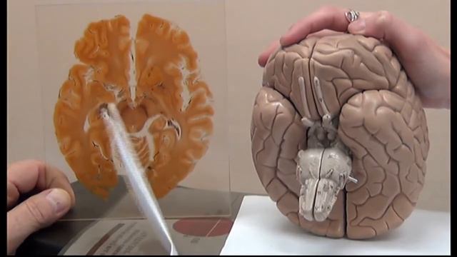 Характеристика срезов головного мозга на различных уровнях