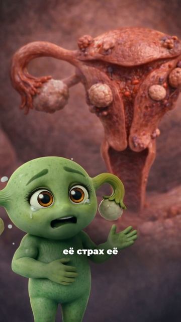 Миома — это часто не про «болезнь».  Это про состояние: «я больше не выдерживаю»