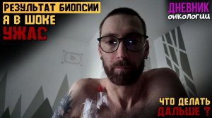 Результат биопсии ужас. Я в шоке. Что делать дальше? Жизнь в диагнозе. Рак крови. Онкология