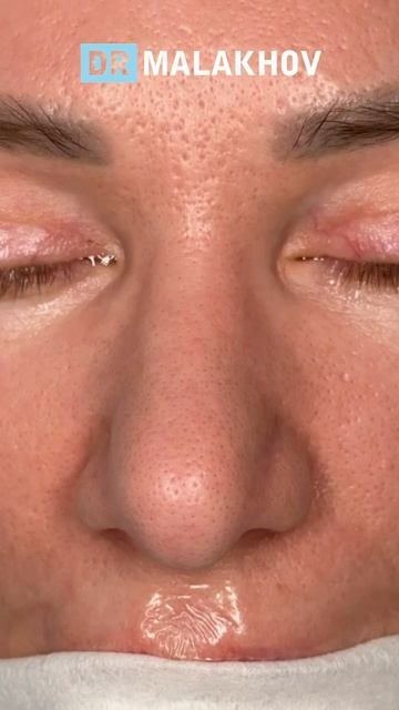 ДО/ПОСЛЕ на операционном столе 😍🙌🏼