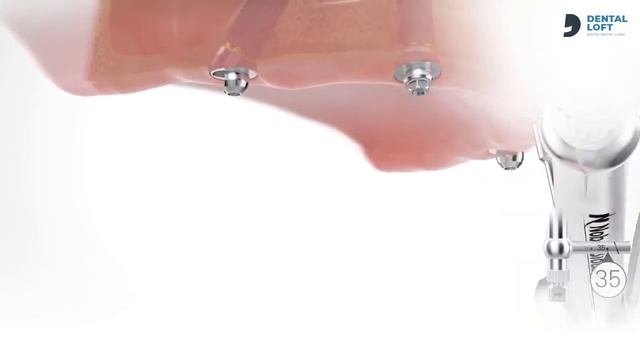 Концепция Аll-on-4