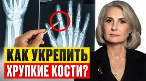 ИСТИННЫЕ причины остеопороза! / Как УКРЕПИТЬ кости в любом возрасте?