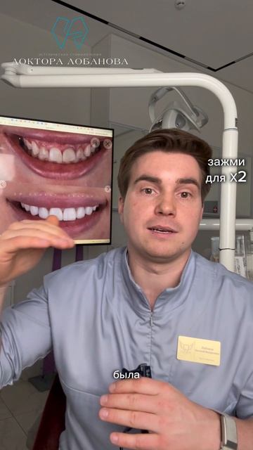 Что такое десневая улыбка?