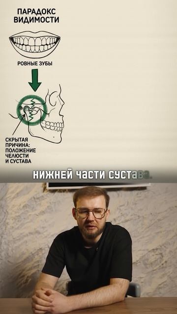 КАК ПОНЯТЬ СВОЙ ПРИКУС В ДОМАШНИХ УСЛОВИЯХ?