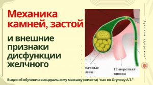 Механика камней, застой и внешние признаки дисфункции желчного . Видео об обучении