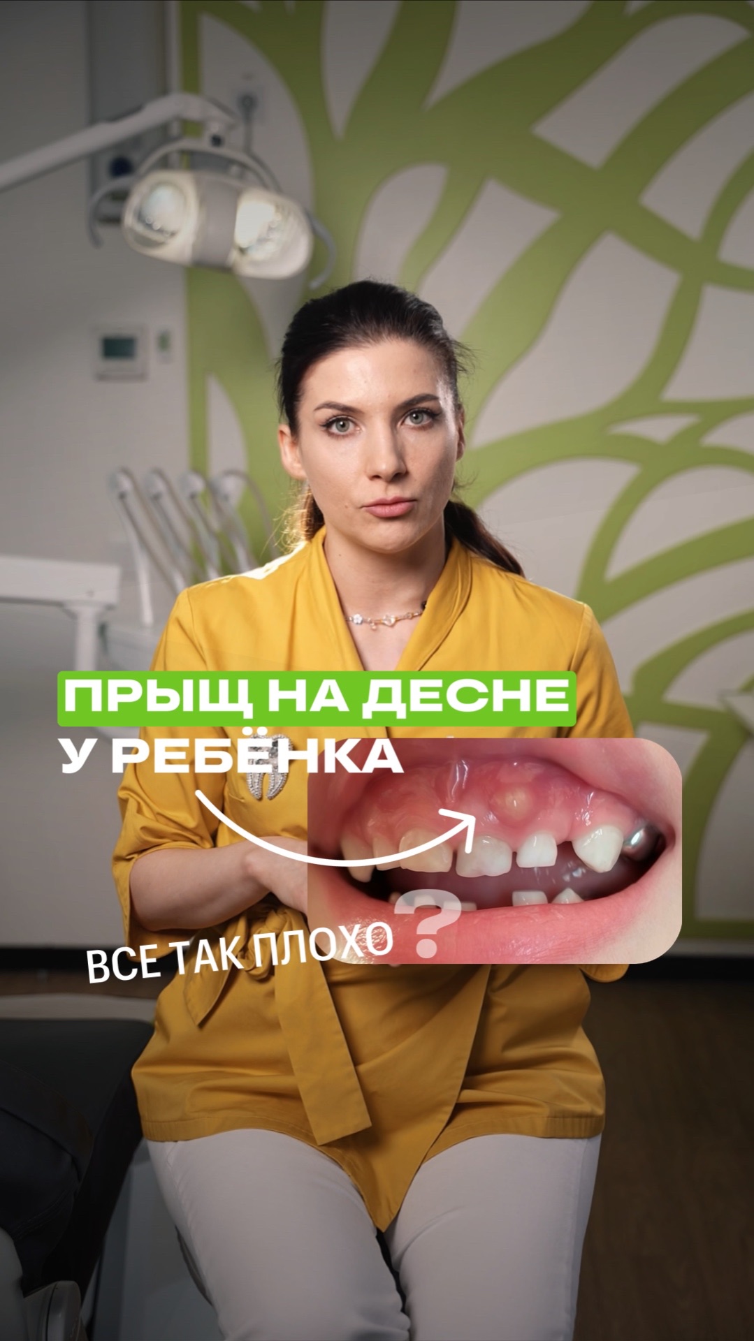 Прыщ на десне у ребёнка — чем опасен👉