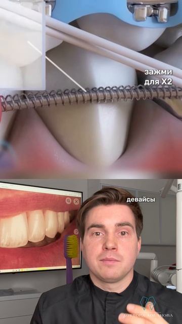 Если Вы стесняетесь своих зубов, улыбки, то это видео для вас