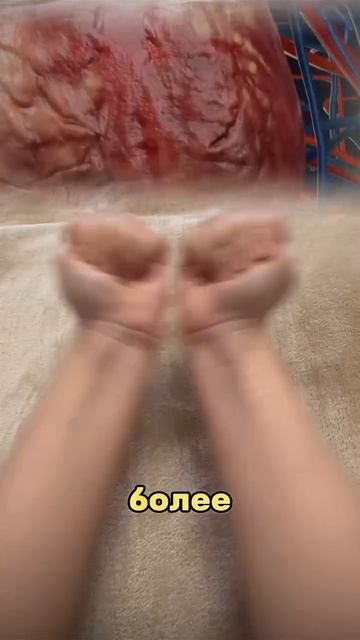 Против бляшек