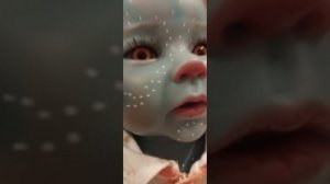 бедный мальчик тук. попал в больницу.