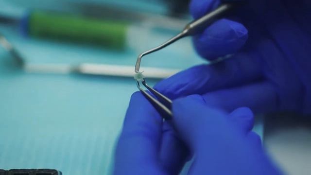 Установка брекет-системы в стоматологии Дентал Лофт