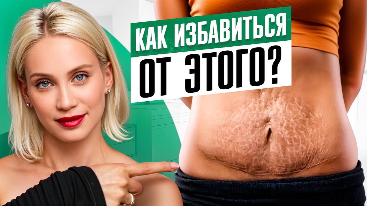Растяжки! Что с ними делать? Самые эффективные и бесполезные метды