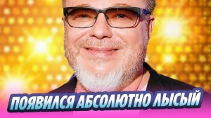 Пресняков появился с абсолютно лысой головой 🔥 Новости Шоу Бизнеса