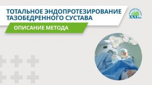 Тотальное эндопротезирование тазобедренного сустава | Медицинский центр «XXI век»