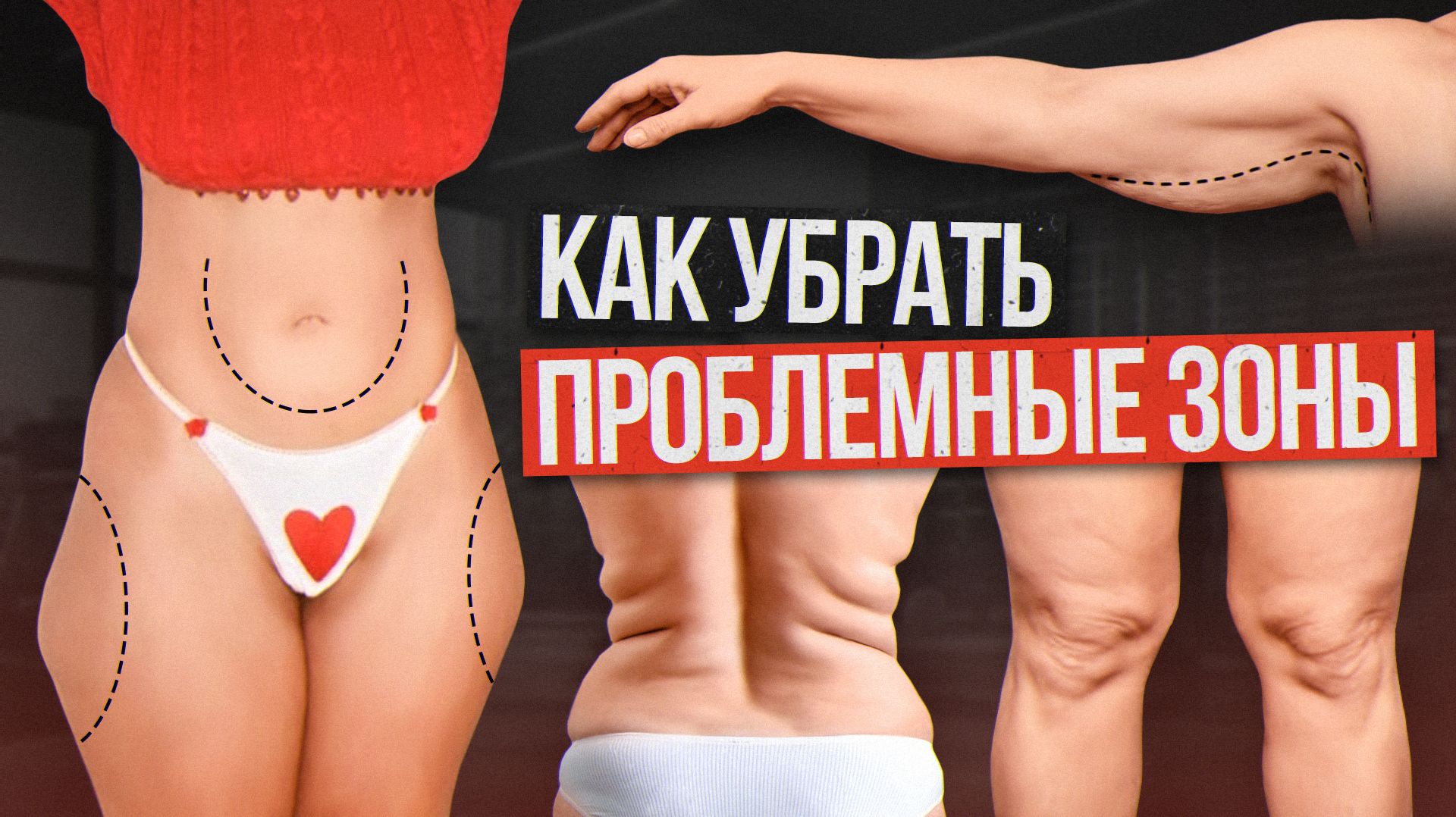 «УПРЯМЫЙ» ЖИР на животе, галифе, валики над коленями, складки на спине