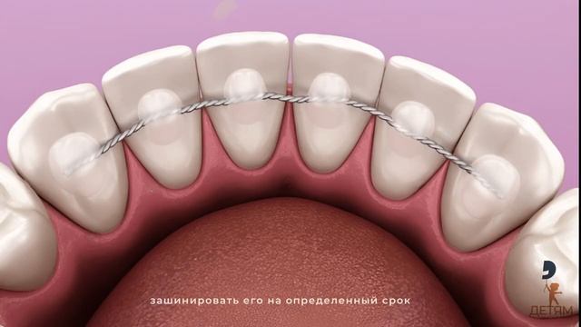 Ребенок сломал зуб. Что делать?