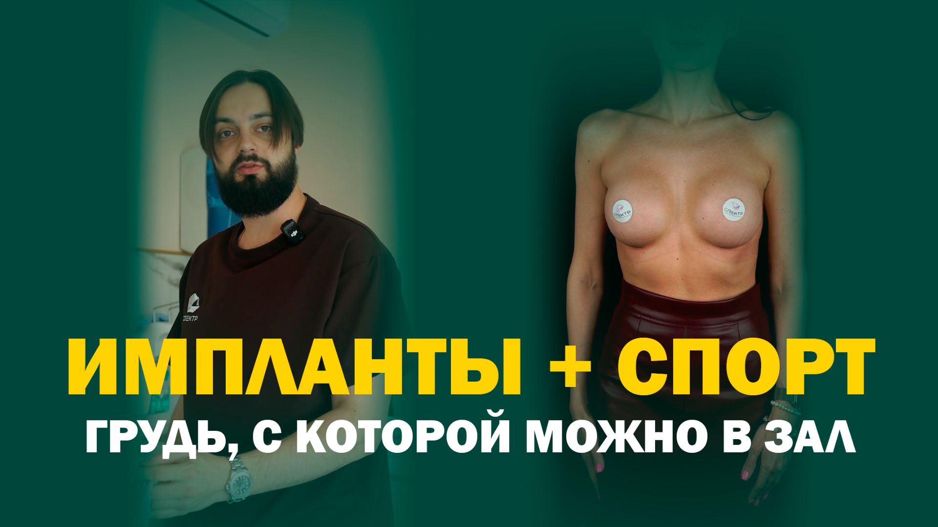 Увеличение груди для спортивной девушки: безопасно и красиво