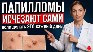 Папилломы и бородавки исчезают сами — врач объясняет почему они растут и как остановить → 👤 #Докт