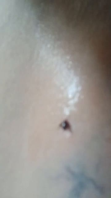 Вцепился клещ.