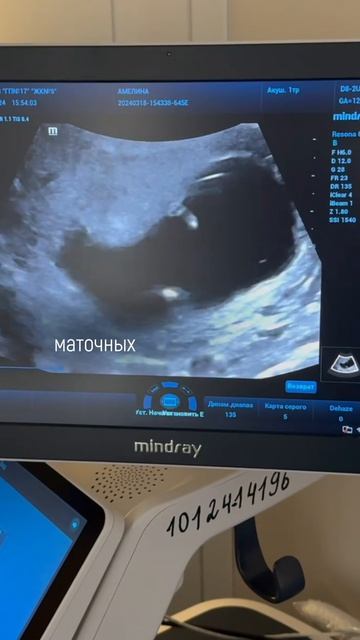 Маленький ребенок на УЗИ