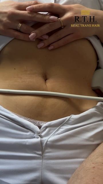 УЗИ почек и мочевого пузыря