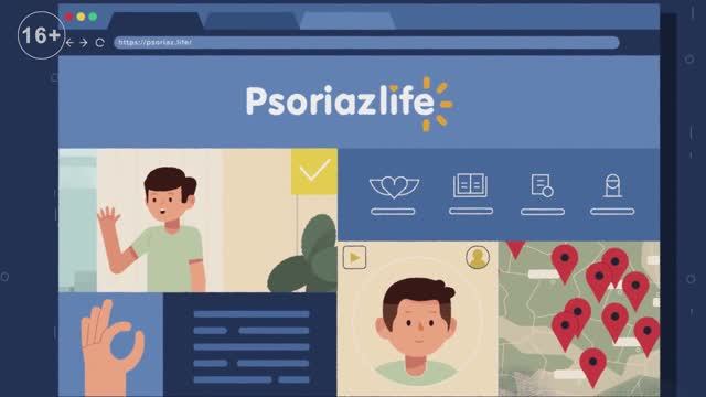 Как лечить псориаз?