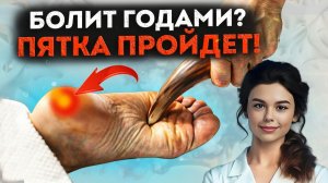 Боль в пятке пройдет! Самый надёжный способ лечения. Пяточная шпора, подошвенный фасциит