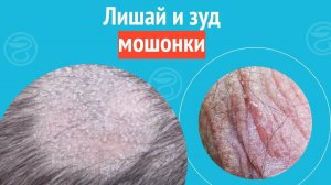 👉 Моллюск в основании члена. Клинический случай №1352