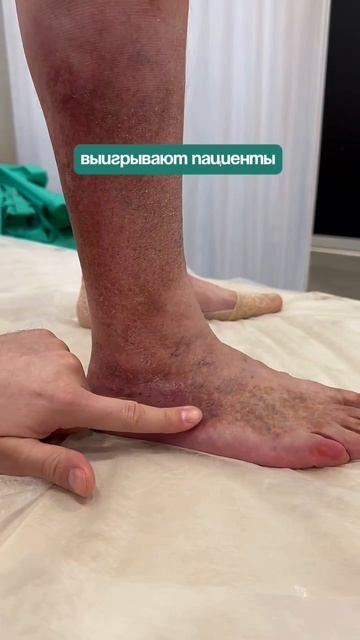 Почему титулы не гарантируют лечение варикоза