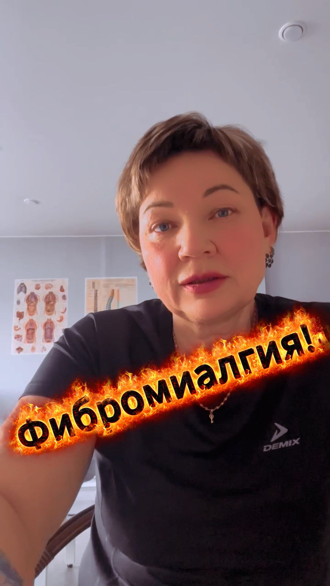 Фибромиалгия!