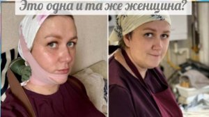 Жирному питону тейпы не помогут. Ей рот надо заклеить