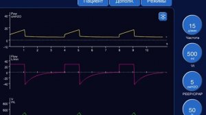 Управление вдохом при ИВЛ Горячев А.С.