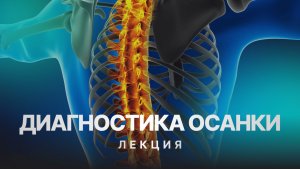 Лекция: Диагностика осанки по ТНП