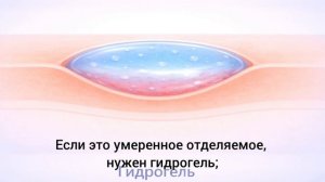 6. Лечение пролежней 2 степени