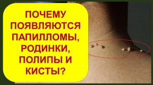 Почему появляются родинки, папилломы, ангиомы, полипы, кисты и гемангиомы?