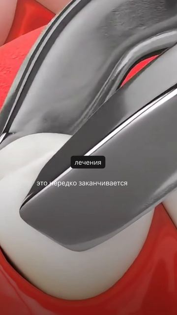 Из-за этого вида кариеса вы навсегда потеряете свой зуб