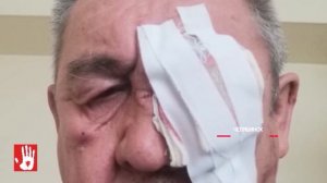 В Челябинске будут судить пассажира автобуса, который серьезно обезобразил водителя.