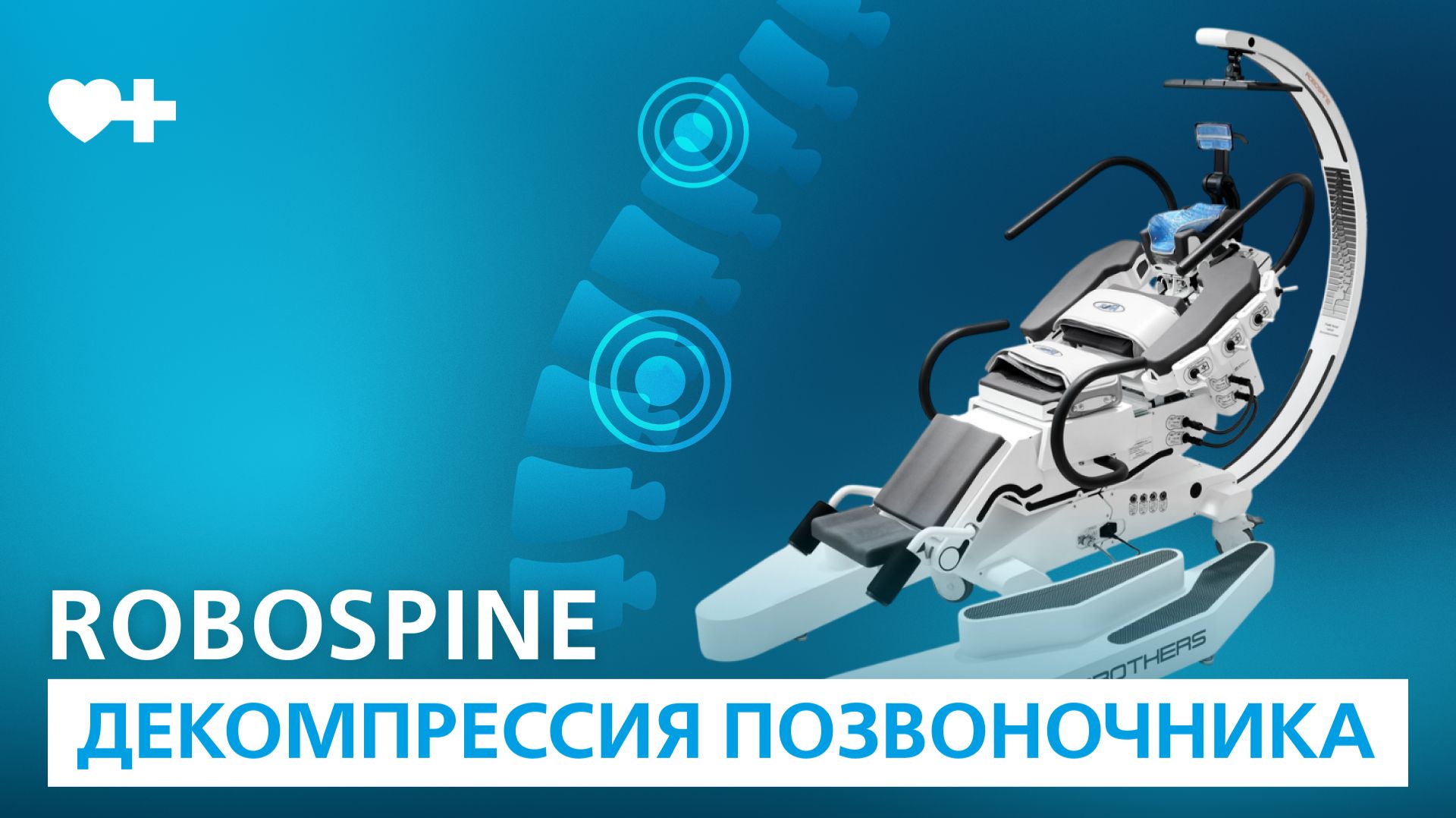 Боль в спине можно убрать без операции? Рассказываем, как работает RoboSpine смотреть онлайн