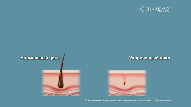 Как остановить выпадение и усилить рост волос — эффективный уход