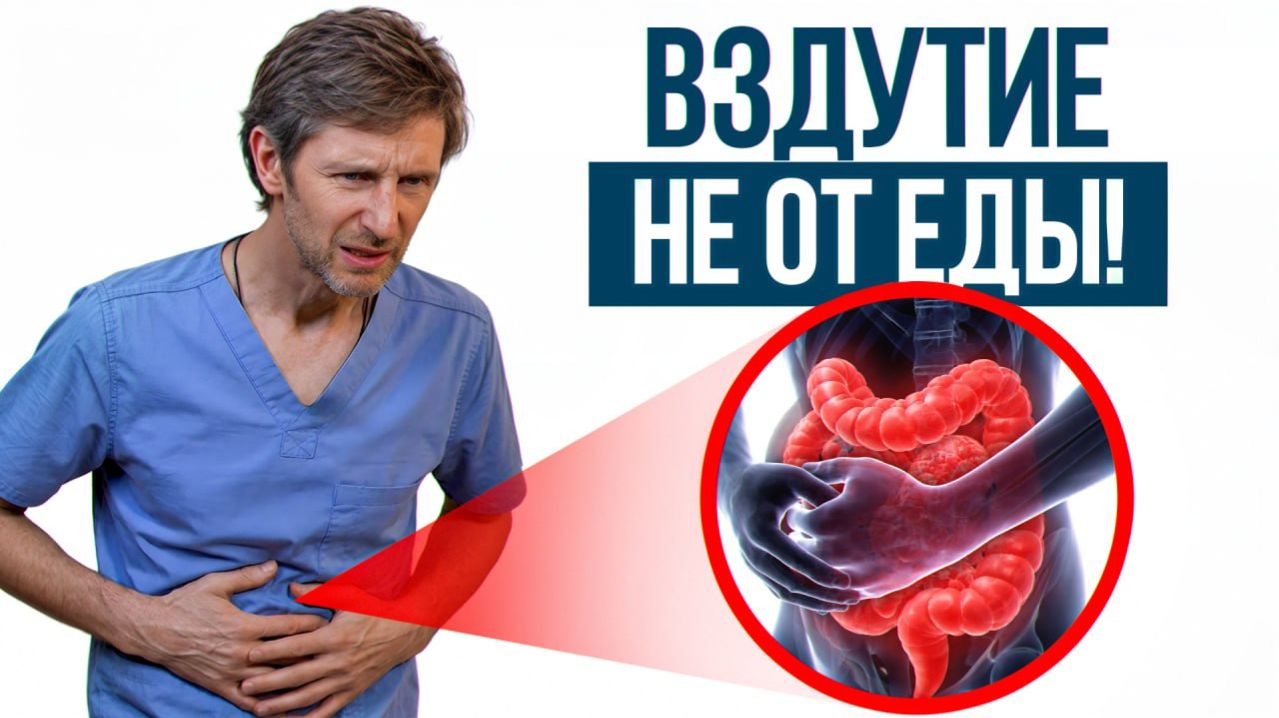 Вздутие живота, газы, метеоризм? ЭТО точно ПОМОЖЕТ! / Как избавиться от вздутия навсегда?!