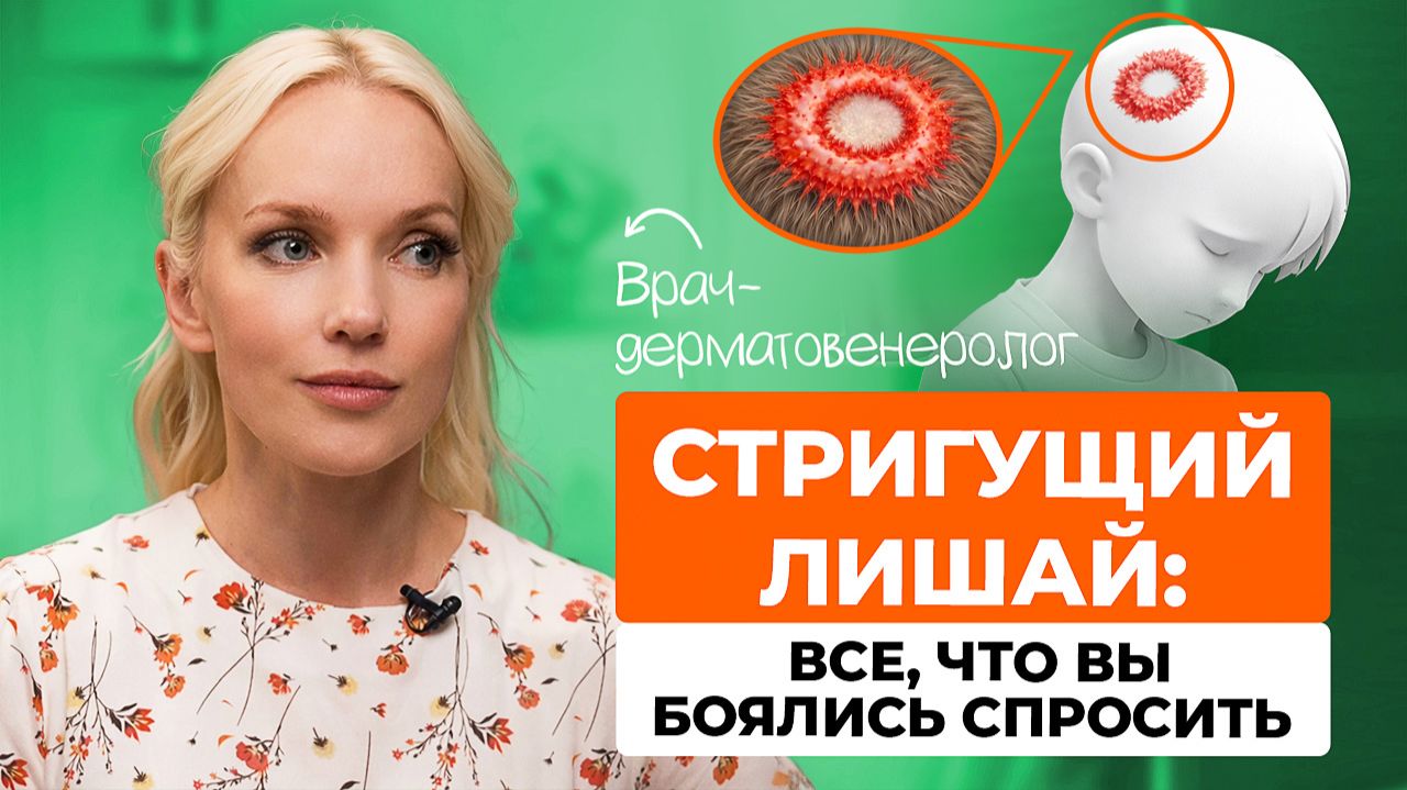 Стригущий лишай: все, что вы боялись спросить