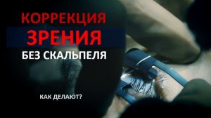 Как делают лазерную коррекцию зрения без скальпеля? Лайфхак