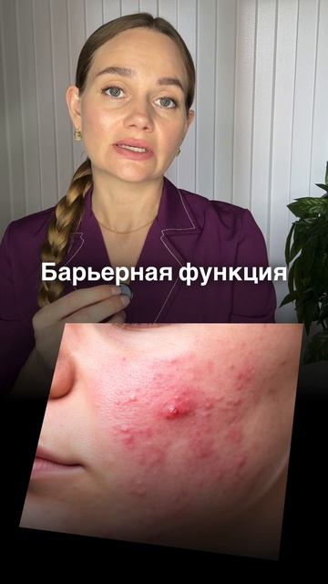 Кортизол бьет по коже ☝🏻