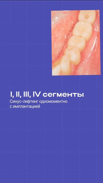 Сложный анамнез — не повод отказывать пациенту в реабилитации 🦷
